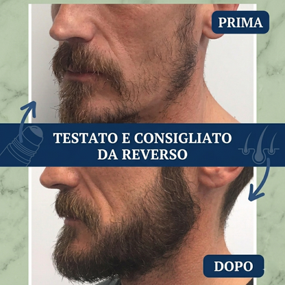 Reverso™